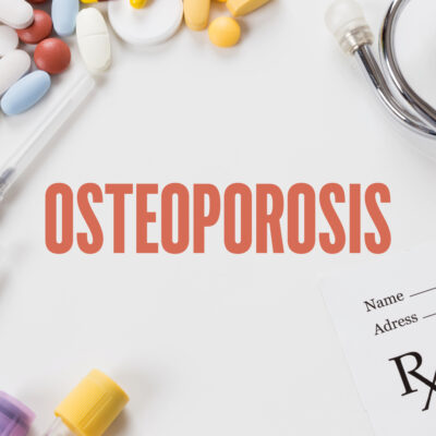 Tips to Prevent Osteoporosis