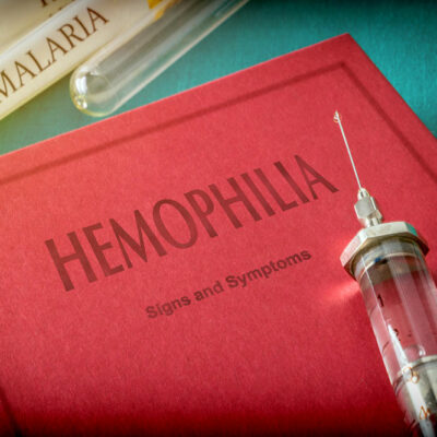 Treatment Options for Hemophilia