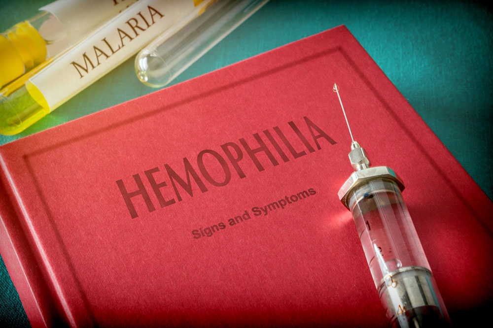 Treatment Options for Hemophilia