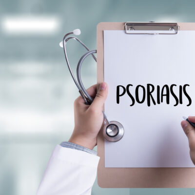 6 Causes of Psoriasis